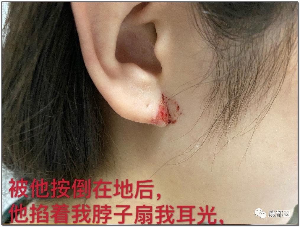 短跑名将张培萌被曝家暴反转,短跑名将张培萌家暴背后