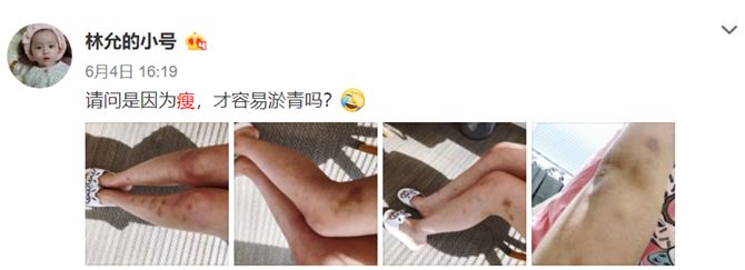 林允奇葩减肥法,林允小号减肥历程