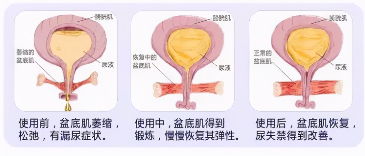 唐艺昕产后复出状态好,唐艺昕产后几个月复出