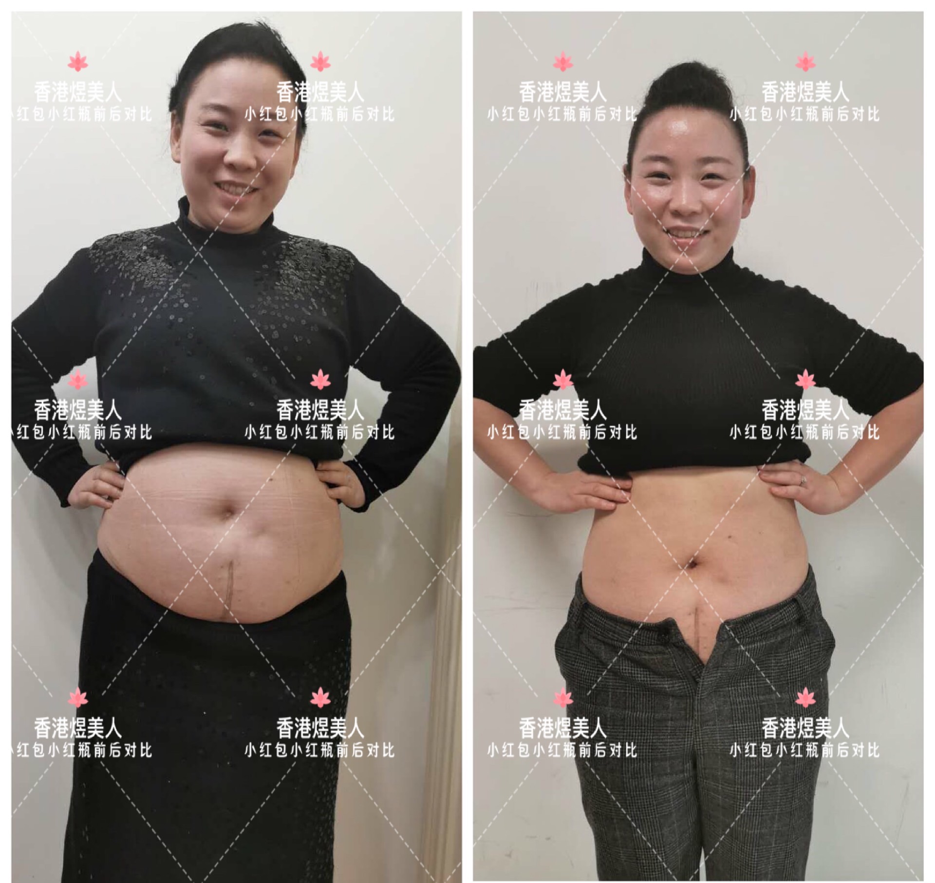 宅家减肥九种小运动,宅家怎么减肥不胖