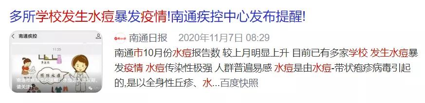 水痘防控知识,健康提示水痘高发准备战痘