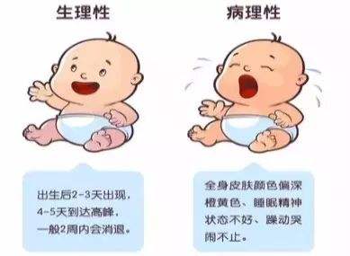 新生儿溶血性黄疸多久可以出院,新生儿溶血性黄疸不治会怎么样