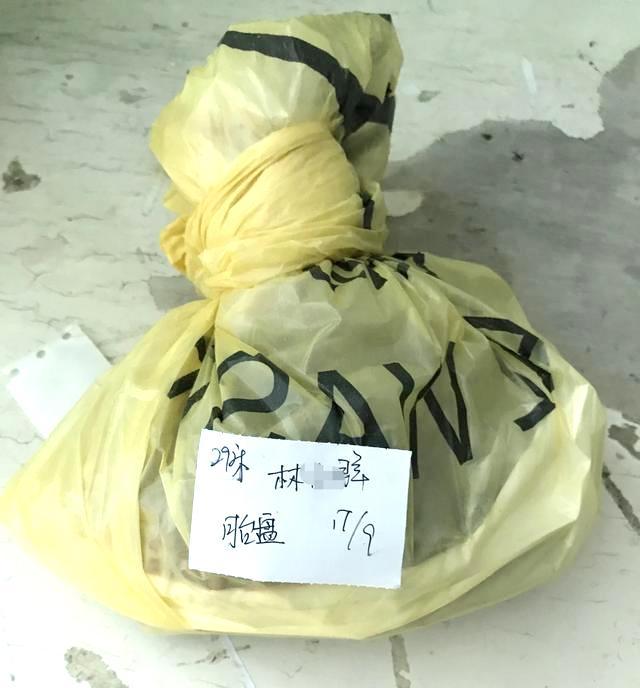 谢依霖后遗症有哪些表现,谢依霖晒孕照大量妊娠纹吓坏观众