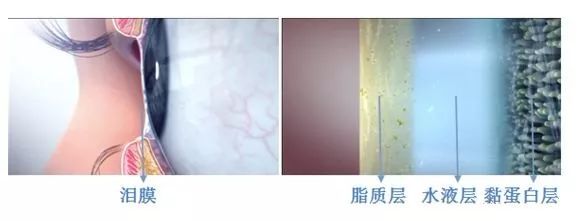 干眼症可以彻底治愈吗,干眼症能彻底治好吗