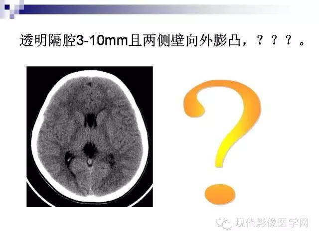 透明隔腔主要是判断什么,透明隔缺如临床意义