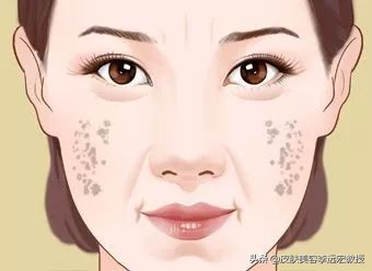 做一个脸上无斑的女人,女人脸上没有斑了