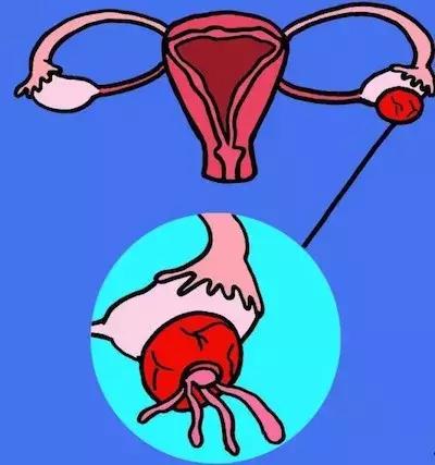 每个月都肚子疼不是月经怎么办,每个月都会小腹痛不是经期