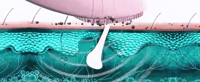 背部搓澡的方法,一个人搓澡怎么搓到后背