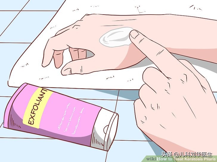 鸡皮状的皮肤病,鸡皮样的疹子是什么病