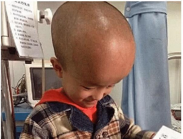 17年前喝“空壳奶粉”的大头娃娃，现在怎么样了？网友：不可原谅