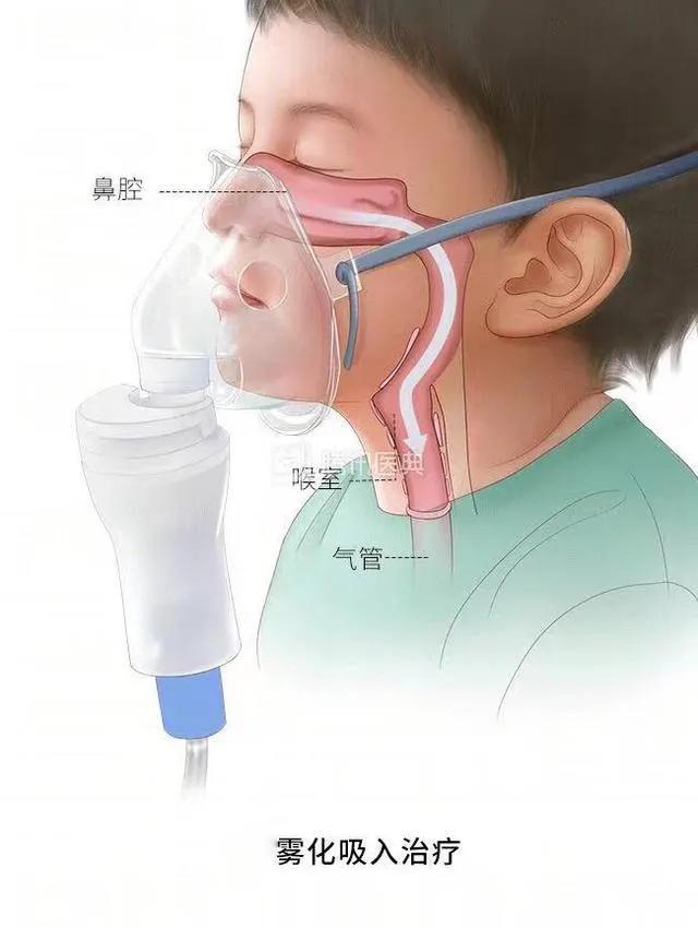 孩子突然喉咙哑了,喉咙突然哑了但是不痛不痒