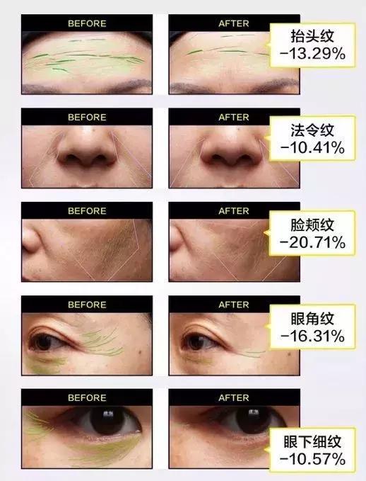 olay超红瓶眼霜成分,olay超a眼霜和a醇面霜一起用吗