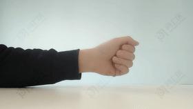 用手机大拇指腱鞘炎能自愈吗,长时间玩手机手腕腱鞘炎的案例