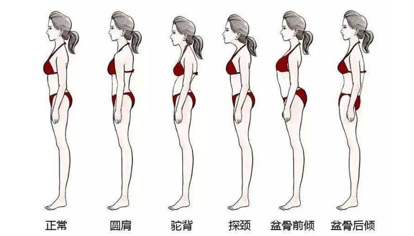 5个少儿常见不良体态，家长不重视影响深远