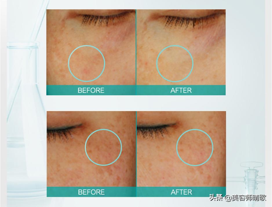 淡斑小白瓶精华二代,小白瓶美白淡斑护肤品推荐