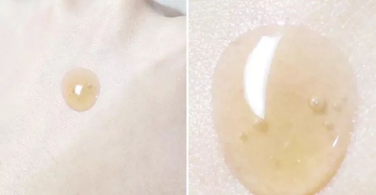 后的秘贴精华和雪花秀的润燥精华,后秘贴精华和资生堂红腰子哪个好