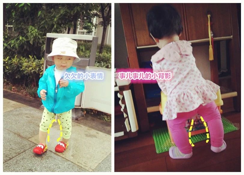 小孩喜欢勾腿是为什么,幼儿罗圈腿会自己好吗