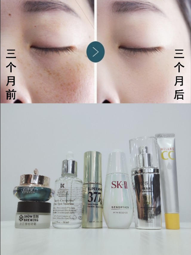 十大祛斑精华,爆款祛斑精华