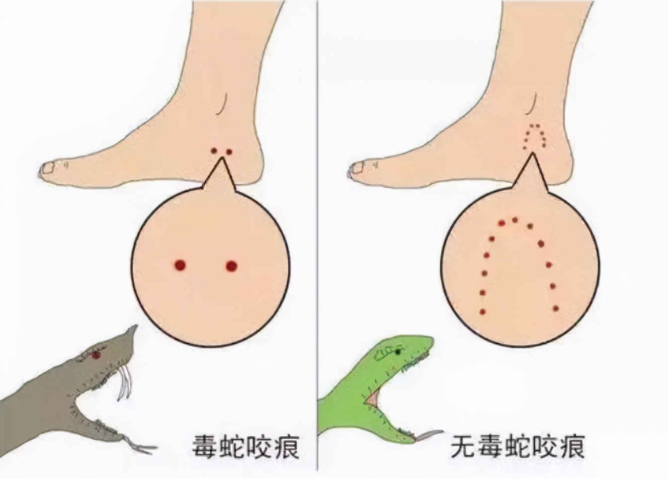 福州38天101起“蛇登门”如此频繁与全球变暖有关吗？如何防蛇？