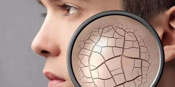 眼干眼涩发痒用什么眼药水,干燥综合征口干眼干吃什么药