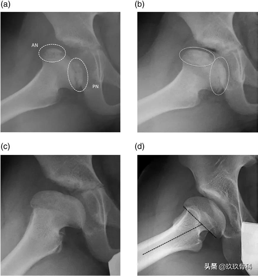 髋膝关节文献精译荟萃