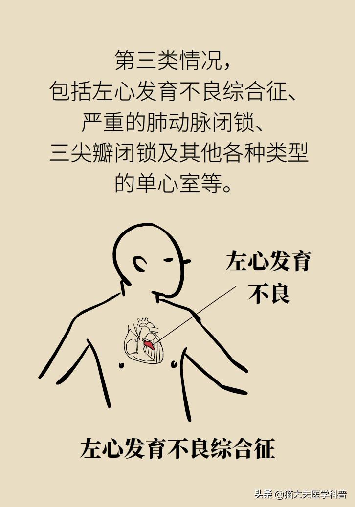 产检查出胎儿有问题,胎儿心脏有问题产检能发现吗