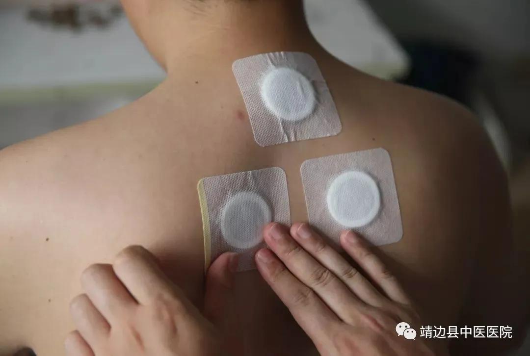 陕西省中医医院三伏贴,榆林市中医院三伏贴
