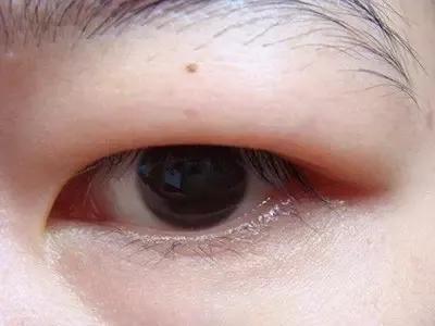 还这么年轻，这神颜小花神颜小生怎么越长越残了…