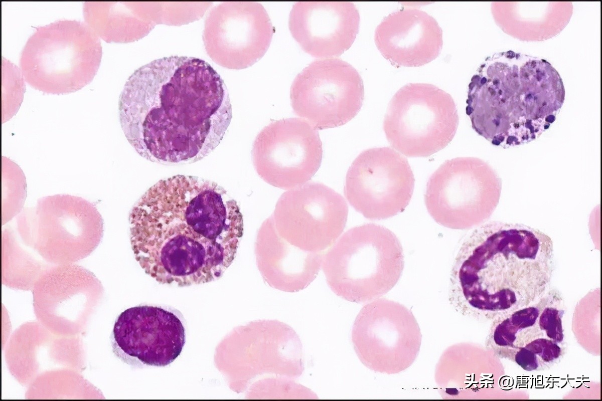 血常规白细胞2.8说明什么问题,血常规白细胞10.5是什么原因