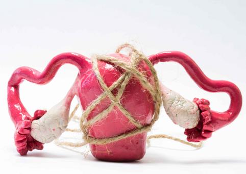 子宫肌瘤的病发症状及危害,子宫肌瘤出现4种信号要警惕