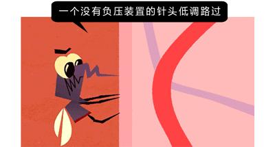 抽血痛扎到肉,抽血会抽到神经吗