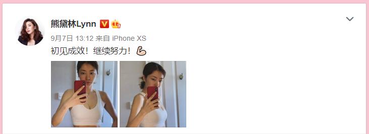 熊黛林倾情加盟|《辣妈辣么美》同款妊娠纹修护产品