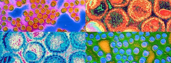 不同暴露途径的hiv感染风险,异性感染hiv风险高吗