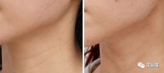 兰蔻粉水屈臣氏官方旗舰店正品,屈臣氏有兰蔻粉水