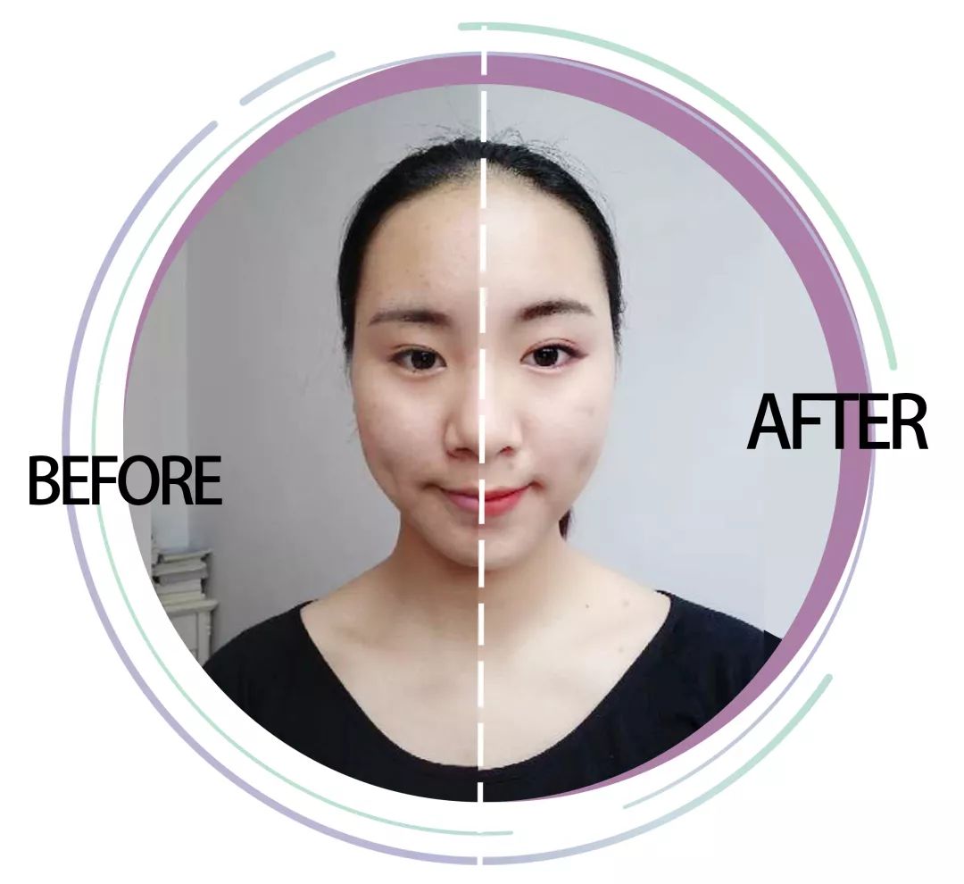 求改善痘痘真实办法,想改变脸上痘痘