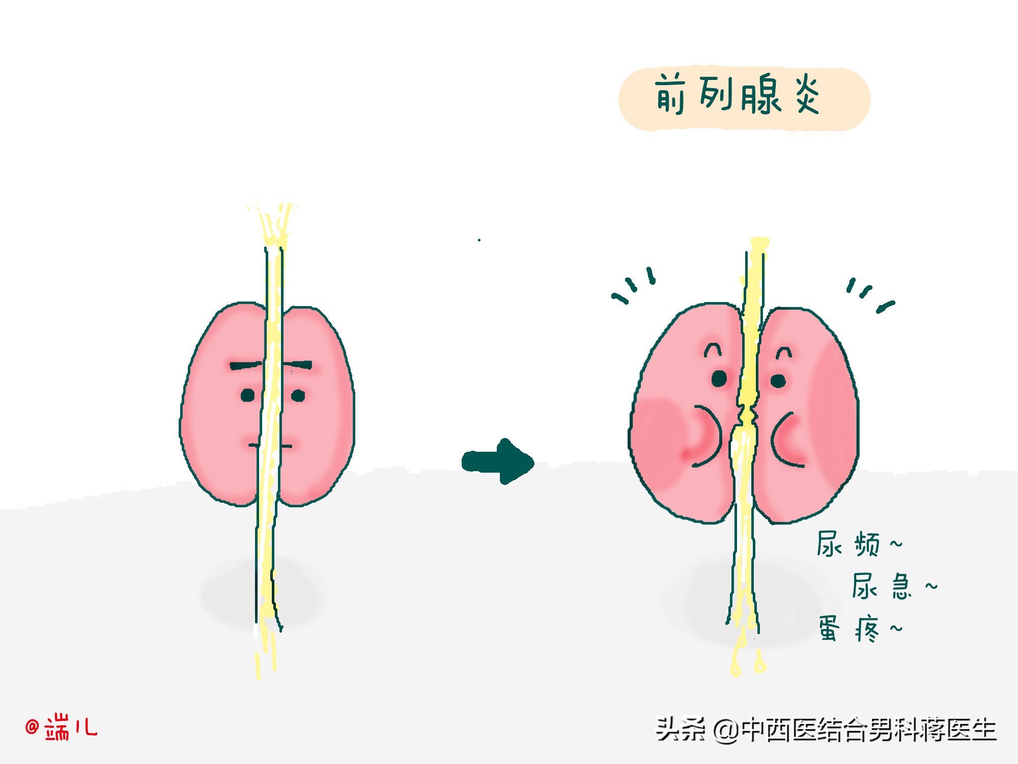蛋疼的5个常见病因,最后1个男科医生很少得!