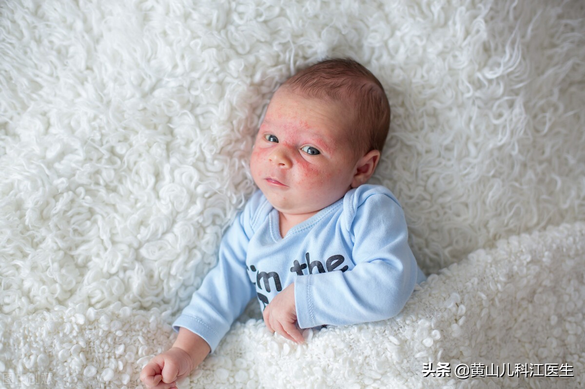 婴儿屁屁红烂怎么护理,婴儿屁屁红怎么护理最好