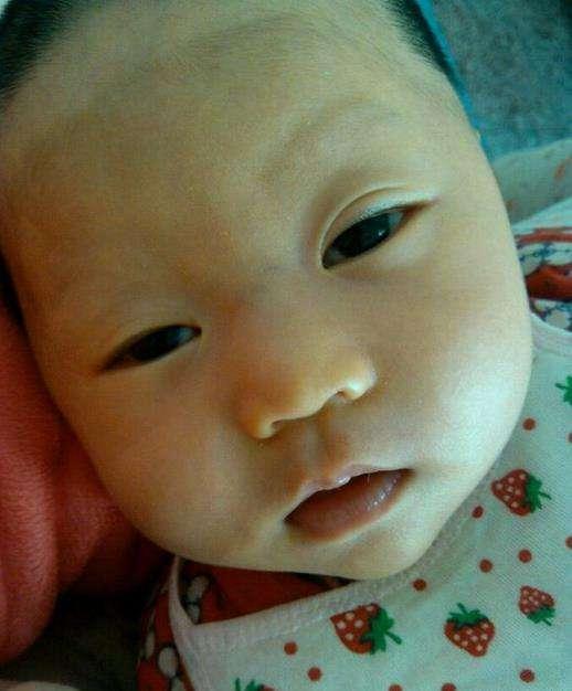 小儿鼻梁有青筋的迷信说法,小儿鼻梁有青筋中医辨证