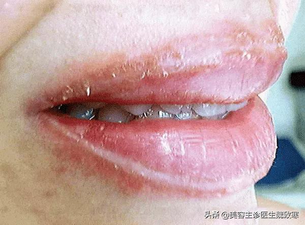 韩式纹眉有哪些种类,韩式纹眉痛吗