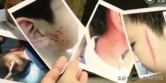 孩子被人欺负家长不讲道理,孩子被欺负如何和对方家长沟通