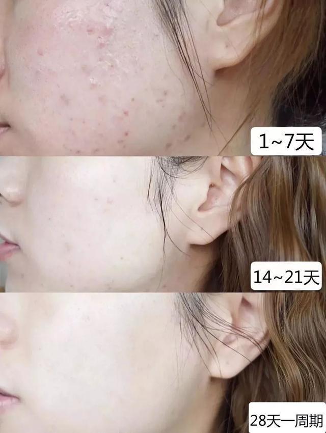 做美容的女人勇气可嘉,打了美容针的女人现在怎么样了