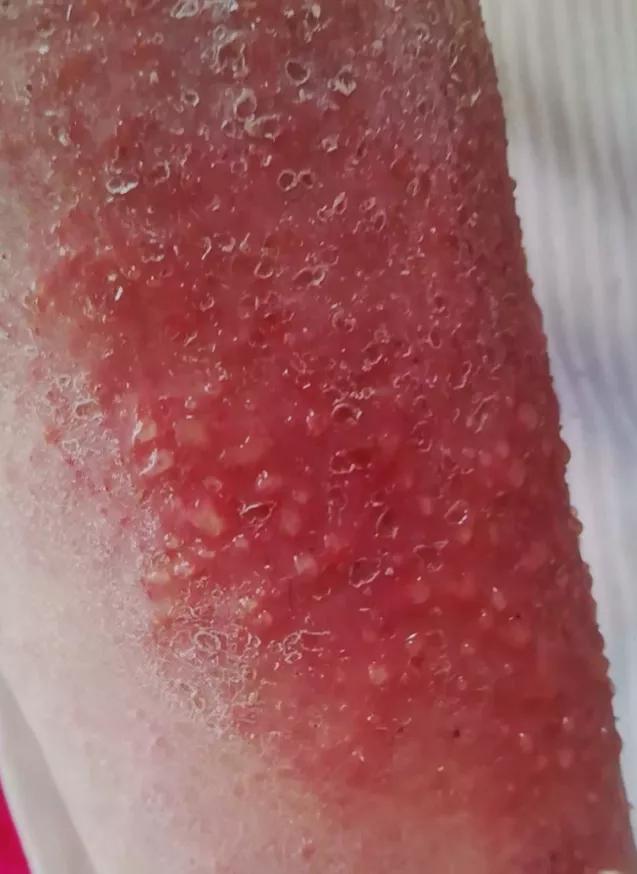 璋﹀窛涓尰,鏉窞璋﹀窛涓尰