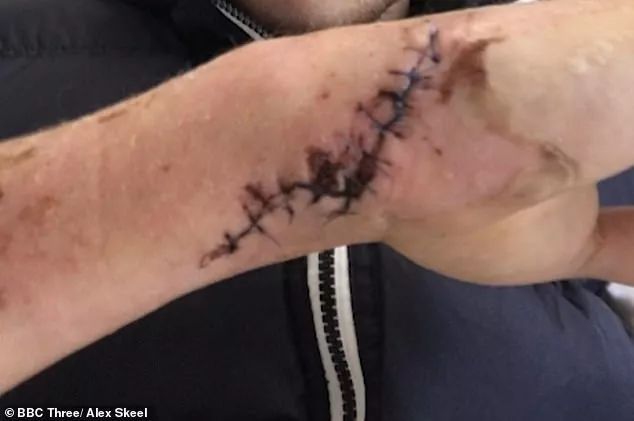 足球教练遭虐待,23岁足球教练被家暴