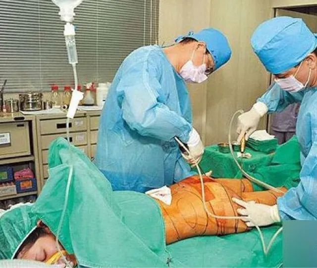 网红抽脂致死原因,杭州网红抽脂各器官衰竭