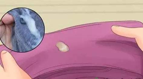 妇科就诊前医生会问哪些问题,去看妇科前一天要注意啥