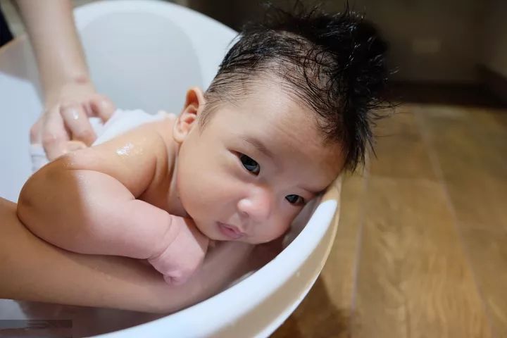 过敏会导致湿疹,孩子食物过敏大面积爆发湿疹