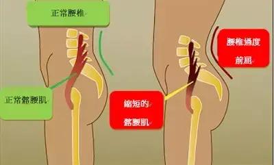 不懂拉伸就不懂健身,拉伸髂腰肌的正确要领