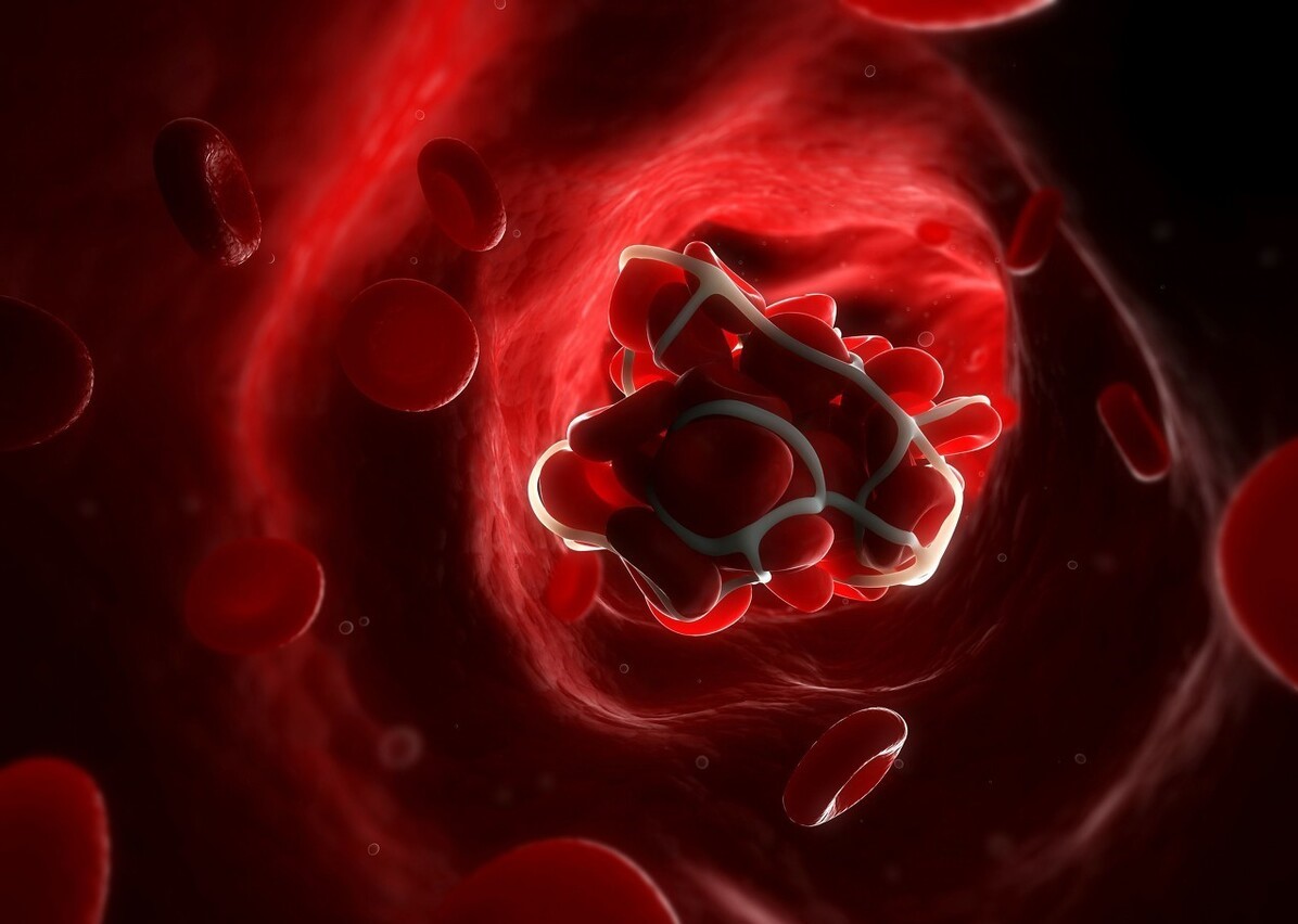 房颤血栓和斑块破裂的血栓一样吗,房颤时预防动脉血栓最有效的药物