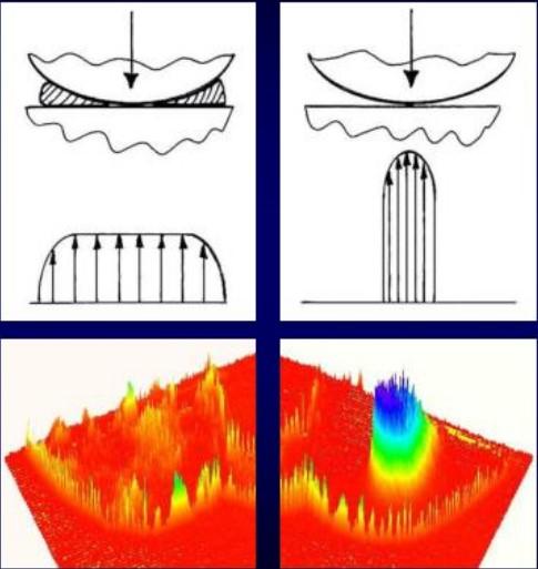 半月板损伤最简单自己鉴别方法,健康之路半月板损伤怎样治疗