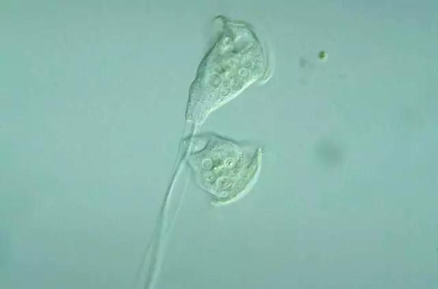 收藏!24种污水处理微生物菌相及指导意义,环保人必看(多图)